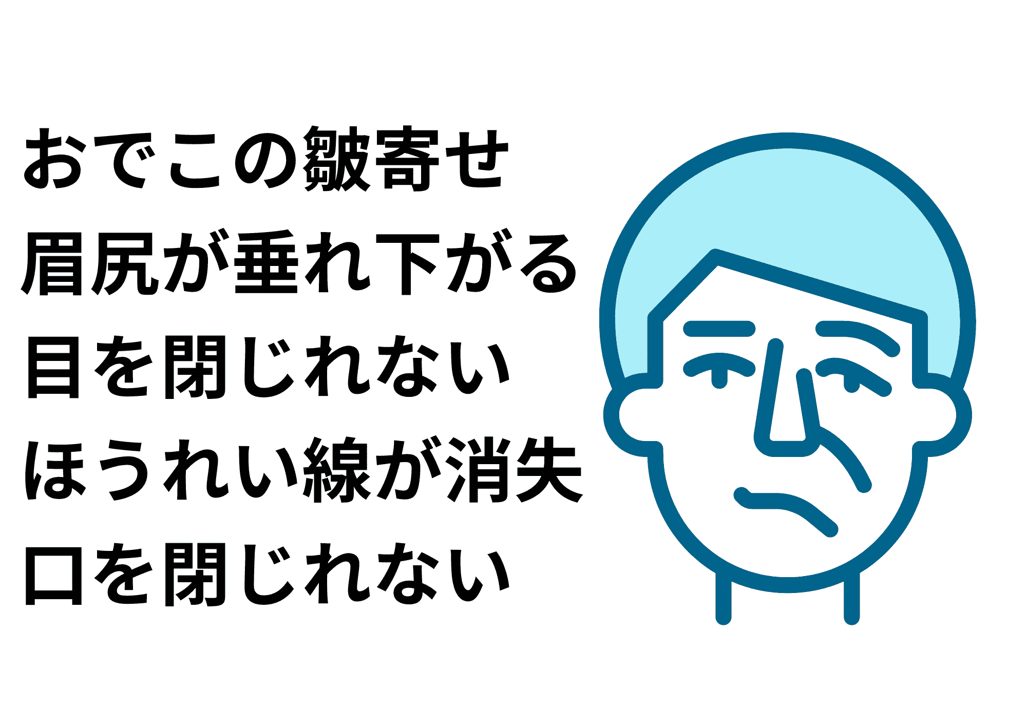 顔面神経麻痺の表情の特徴