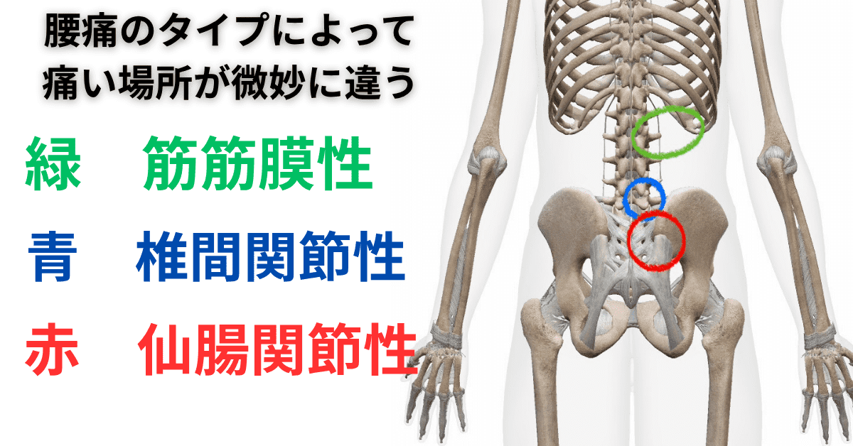 腰痛のタイプによって痛い場所は微妙に違う
